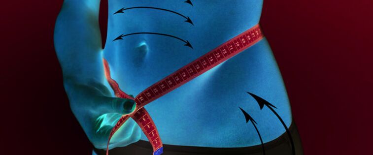 Reduzierung des Unterhautfettgewebes an Bauch und Hüfte nach Gewichtsverlust innerhalb einer Woche